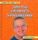 Tapa de Luke Has Down's Syndrome (Like Me Like You)