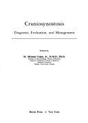 Tapa de Craniosynostosis