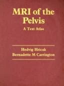 Tapa de MRI of the pelvis