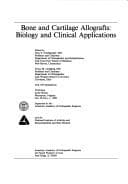 Tapa de Bone and Cartilage Allografts