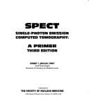 Tapa de Spect: Single-Photon Emission Computed Tomography