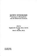 Tapa de Down Syndrome