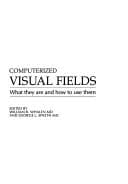 Tapa de Computerized visual fields