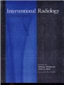 Tapa de Interventional radiology