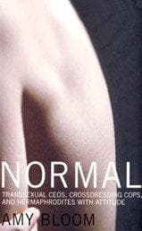 Tapa de Normal