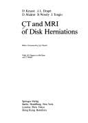 Tapa de CT and MRI of disk herniations