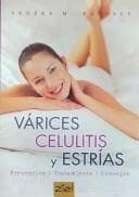Tapa de Varices Celulitis y Estrias/ Varicose Veins Cellulite and Strech Marks