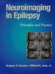 Tapa de Neuroimaging in epilepsy