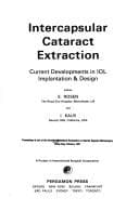 Tapa de Intercapsular Cataract Extraction