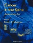 Tapa de Cancer in the Spine E Book