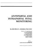 Tapa de Antepartal and Intrapartal Fetal Monitoring