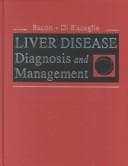 Tapa de Liver disease