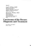 Tapa de Carcinoma of the Breast