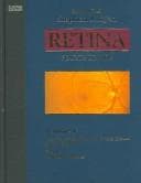 Tapa de Retina
