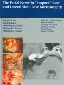 Tapa de Facial Nerve in Temporal Bone and Lateral Skull Base Microsurgery