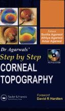 Tapa de Step by Step Corneal Topography