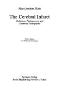 Tapa de The cerebral infarct