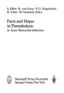 Tapa de Facts and Hopes in Thrombolysis in Acute Myocardial Infarction