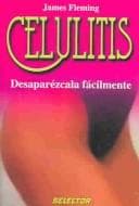 Tapa de Celulitis