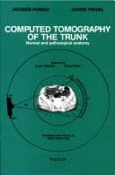 Tapa de Computed Tomography of the Trunk