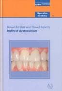 Tapa de Indirect restorations