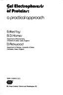 Tapa de Gel electrophoresis of proteins