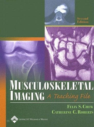 Tapa de Musculoskeletal imaging