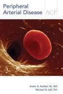 Tapa de Peripheral arterial disease