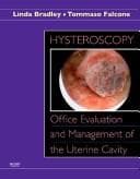 Tapa de Hysteroscopy
