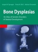 Tapa de Bone dysplasias