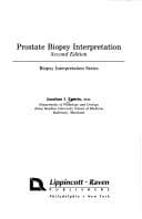 Tapa de Prostate biopsy interpretation