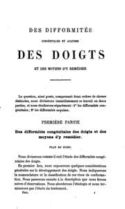 Tapa de Des Difformites congenitales et acquises des doigts et des moyens d'y remedier