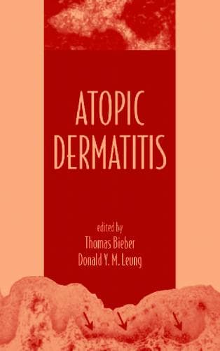Tapa de Atopic Dermatitis
