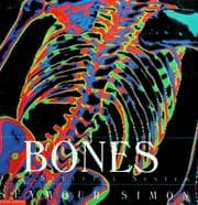 Tapa de Bones