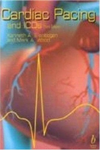 Tapa de Cardiac Pacing and ICDs