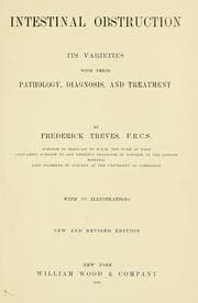 Tapa de Intestinal obstruction; its varieties