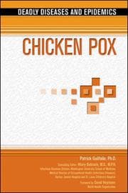 Tapa de Chicken pox