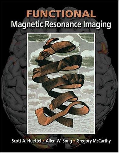 Tapa de Functional magnetic resonance imaging