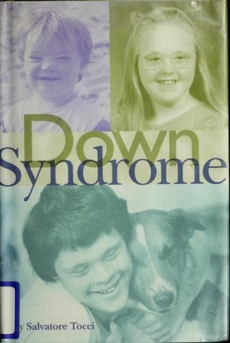 Tapa de Down syndrome