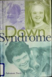 Tapa de Down syndrome