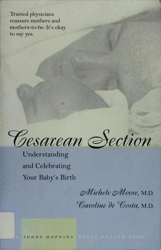 Tapa de Cesarean section
