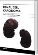 Tapa de Renal Cell Carcinoma