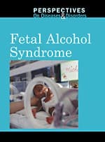 Tapa de Fetal alcohol syndrome