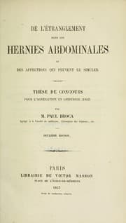 Tapa de De l'étranglement dans les hernies abdominales