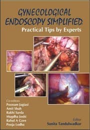 Tapa de Gynecological Endoscopy Simplified Practical Tips By Experts