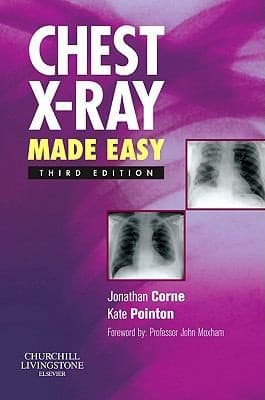 Tapa de Chest Xray Made Easy