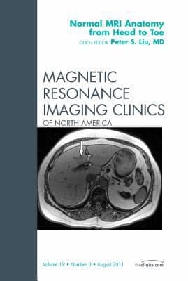 Tapa de Normal Mri Anatomy From Head To Toe