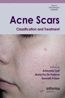 Tapa de Acne Scars Classification And Treatment