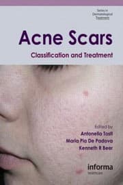Tapa de Acne Scars Classification And Treatment
