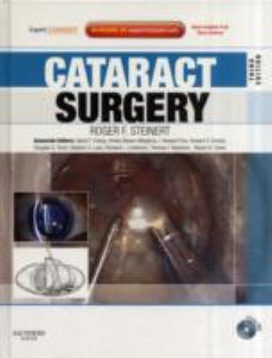 Tapa de Cataract Surgery